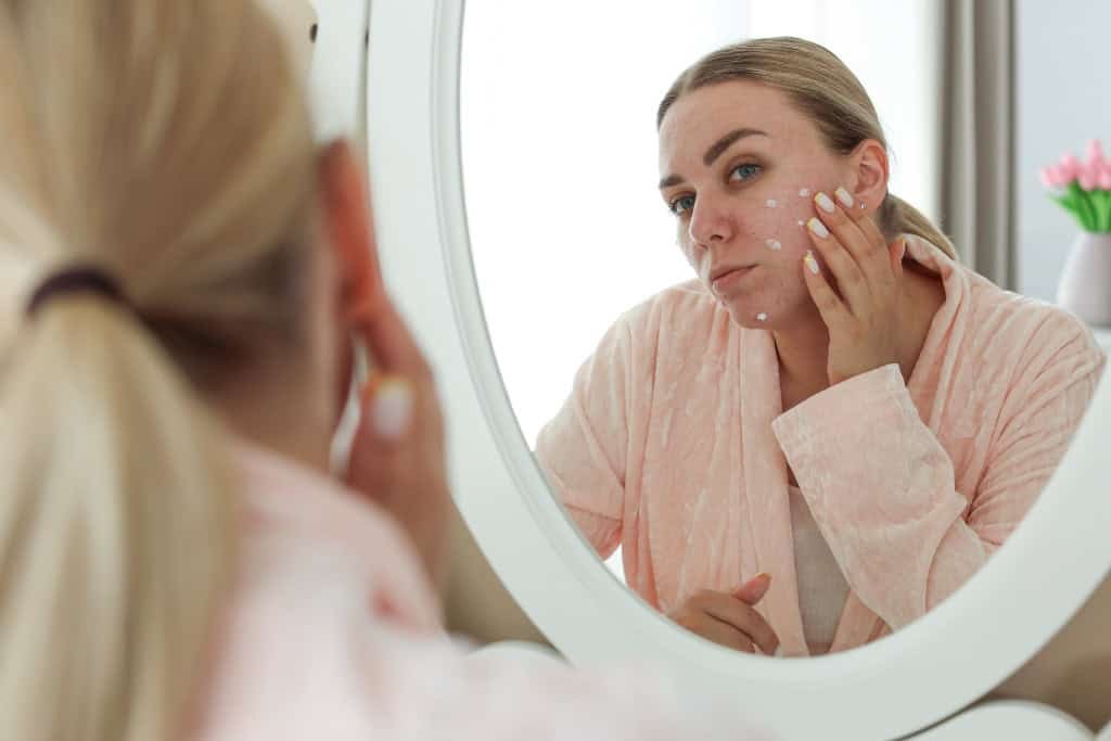 vegan acne skincare